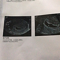 有那个大神能帮我解围，我到底该不该再等等😤