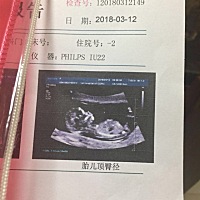 会看nt看性别图的姐妹看过来😄