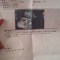 各位宝妈，怀孕九周出现心跳没有搏动，真的要拿掉吗？