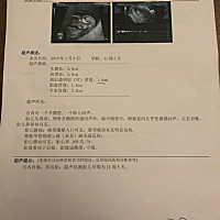 今天11周5天，去做了nt，能看到宝宝一直在动，医生说各项指标都不错，大家来接好运吧！之前还一直担心前...