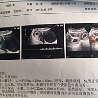 请大神猜猜是男宝还是女宝❤️