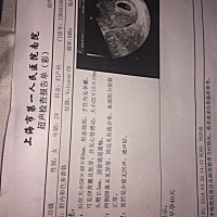 能看出来男宝女宝吗。嘻嘻