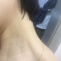 有没有宝妈跟我一样悲哀的  脖子上有好多黑纹纹  就像没洗干净一样  还涨了好多颈纹   有什么办法  这个...