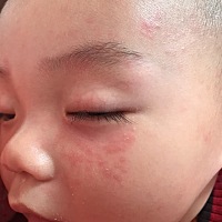 没有人知道脸上长得是什么？