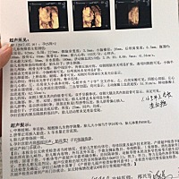 37周了，二胎还是横位，不知道男女，把脉是男的不知道准不准，希望是个女宝宝。