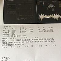 宝宝快要出生了，好期待是男是女