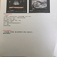 nt顺利通过，好开心，紧张的心终于放下来了，有谁会看男女，纯碎好奇^_^