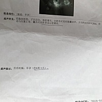 孕妈们，看看我的是男孩👦还是女孩👧，好奇啊