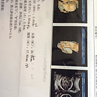 是男宝还是女宝呀，宝妈们帮忙研究一下 🤣