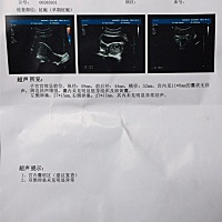 这是啥意思啊，担心死了