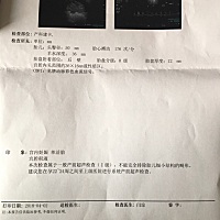 帮忙看看有没有什么问题，医生说孩子有点小