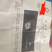 验血说是男孩，看着怎么有点像女孩的数据