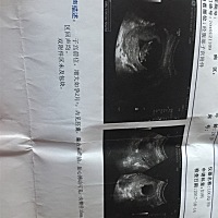 补发两个月时的样子😁