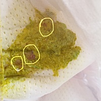 宝宝拉的便便是怎么了