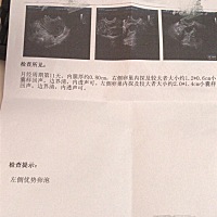 请大家帮忙看看多久可以排卵？