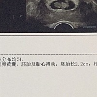 这么小的小东西，就是我的宝宝么，今天去做b超显示八周➕6，但是按月经算已经10➕2,孕囊小宝宝大，不知...