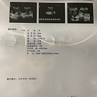 大家帮忙看看男女 17周