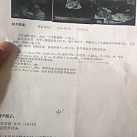 nt单子胎盘低置有没有知道的宝妈传授些经验吗？顺便想问一下能不能看出男宝女宝.