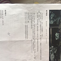 胎盘下缘覆盖宫颈内口，有知道的宝妈吗？严重么，顺便请大神看看是男孩女孩,谢谢