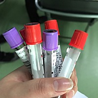 还好还好，六管血。今天建卡做NT，花了2000多，各位宝妈们是多少啊？