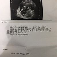 各位能看出来是男宝女宝吗？