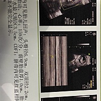 大家帮忙看看是男宝还是女宝啊！