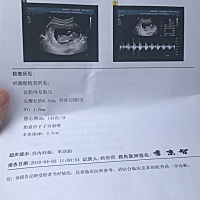 能帮忙看看这是男宝还是女宝吗，