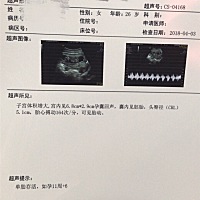 今天第一次产检，小家伙b超动的不行，连做b超的医生都笑了，脚踢，然后小鱼似的跳起来，看着还挺搞笑的...