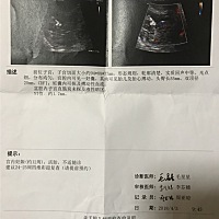 今天做了NT，一切都很顺利，医生说发育很好，并且本人从怀孕到现在没有任何反应，跟之前一样，能吃能睡...