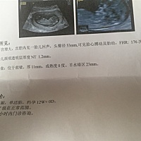 宝妈们，我这个nt检查羊水是不是太少了