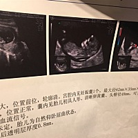 感觉是男宝，对吗？