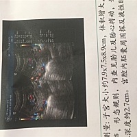 想问一下各位宝妈，怀孕刚12周做彩超检查感觉胎儿还没有成型正常吗？会不会是发育缓慢呀，NT检查1.0， ...