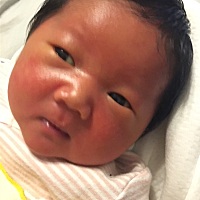 宝宝脸上长的白点是什么呢？有点像粉刺