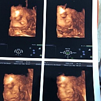 男孩or女孩？小家伙快点出来吧…