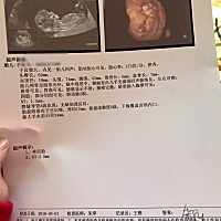 有没有会看男宝女宝的，帮忙看一下，超级好奇…