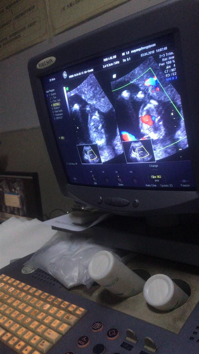 各位亲们，有谁看的懂？我想知道一下是男是女