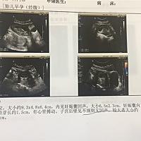 男宝还是女宝？会看的帮忙看下，谢谢！🙏