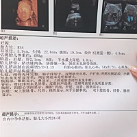 亲们帮忙看下男女😄