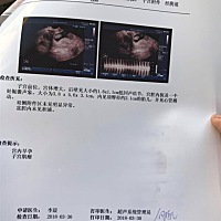 帮忙看下男宝女宝？谢谢🙏