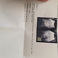 检查了下一直怀不上怎么回事