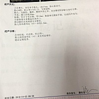 想知道是不是女儿，想生个女儿，健康快乐成长！