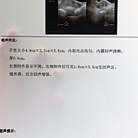 医生说 没个10天半个月，不会来的… 才3天我就来了！这个是几个意思？ 这个囊肿要紧吗？