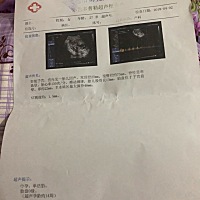 🤔👻宝妈们，哈哈😄大家帮我看看，是男孩还是女孩，好好奇，第一次怀孕，好激动，好想知道，好准...