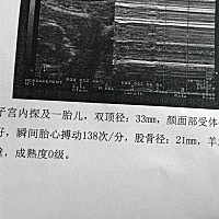 是男孩还是女孩呢，有懂的吗