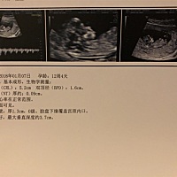 大家帮忙看看，能看出男宝女宝不？