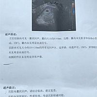第一次去检查，医生说子宫积液，孕酮低，是先兆流产，开了一堆安胎药，让每天打黄体酮，也没说打多少天...