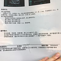 有没有专业人士？帮忙猜一下是男宝还是女宝，