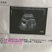 特别想留住宝宝，但是还是生化妊娠了，现在才出少量血，现在宫内有3.6×2.4cm囊肿无回声，可能是我那未...