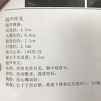 想知道是男孩还是女孩