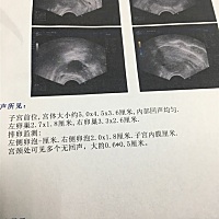 请问是不是快排卵了？各位姐妹们